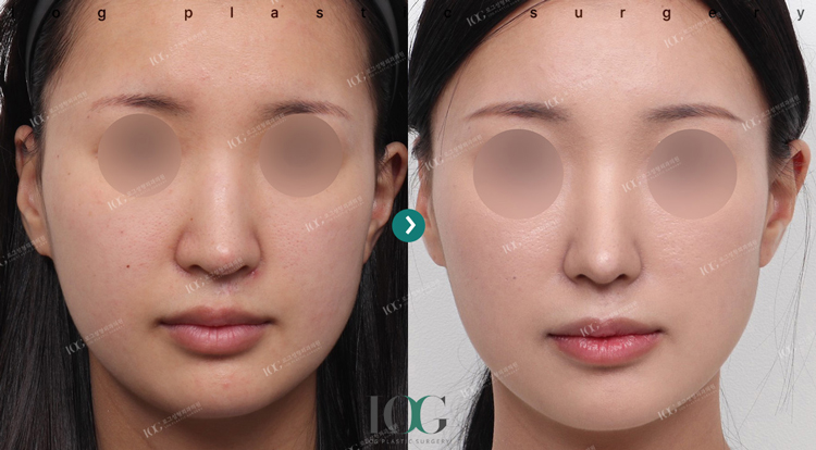 治療前・治療後